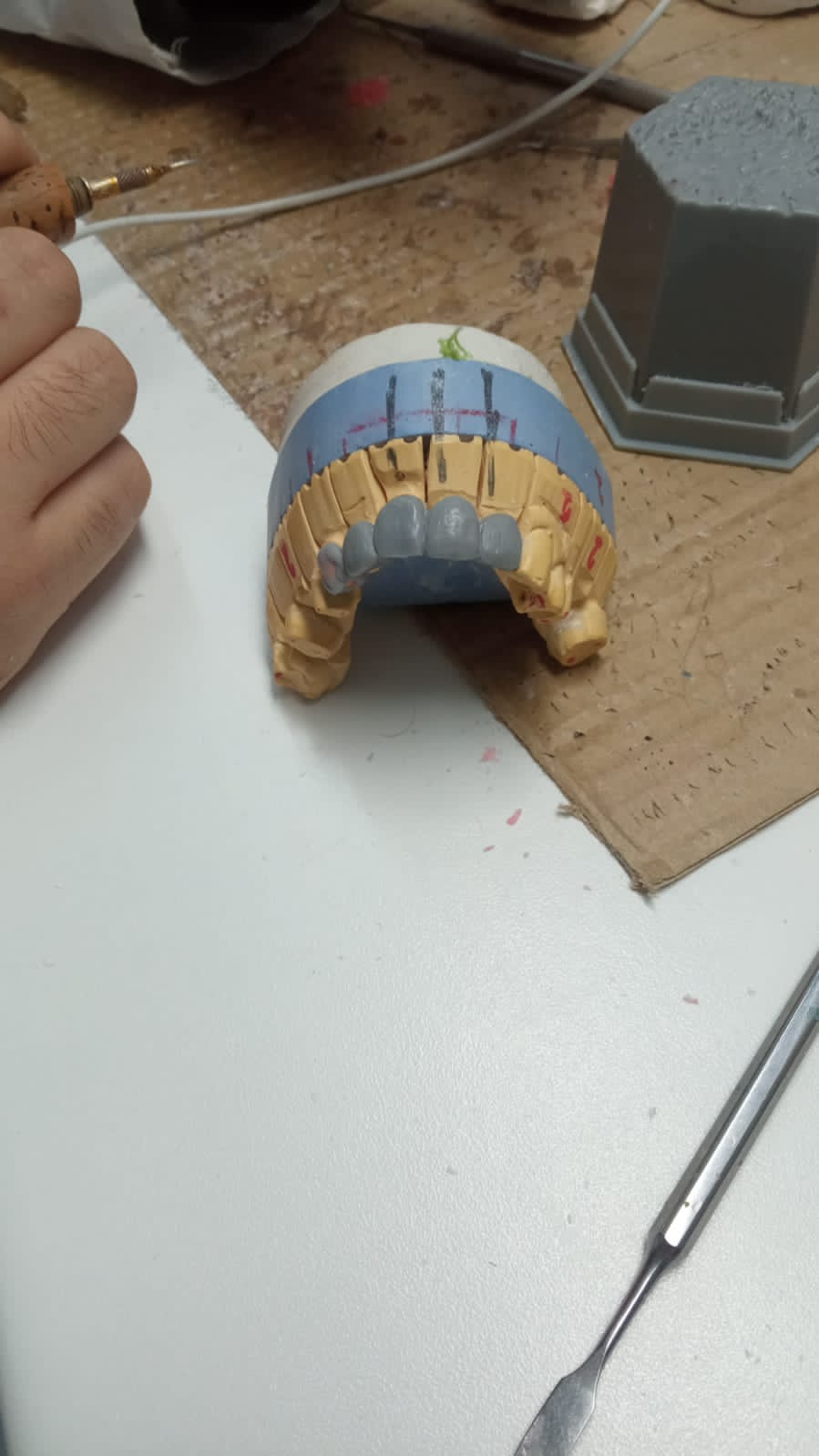 Стоматология ортопедическая