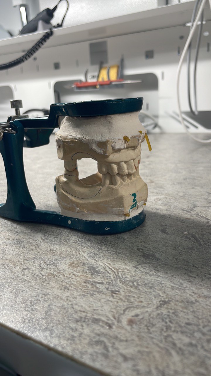 Стоматология ортопедическая